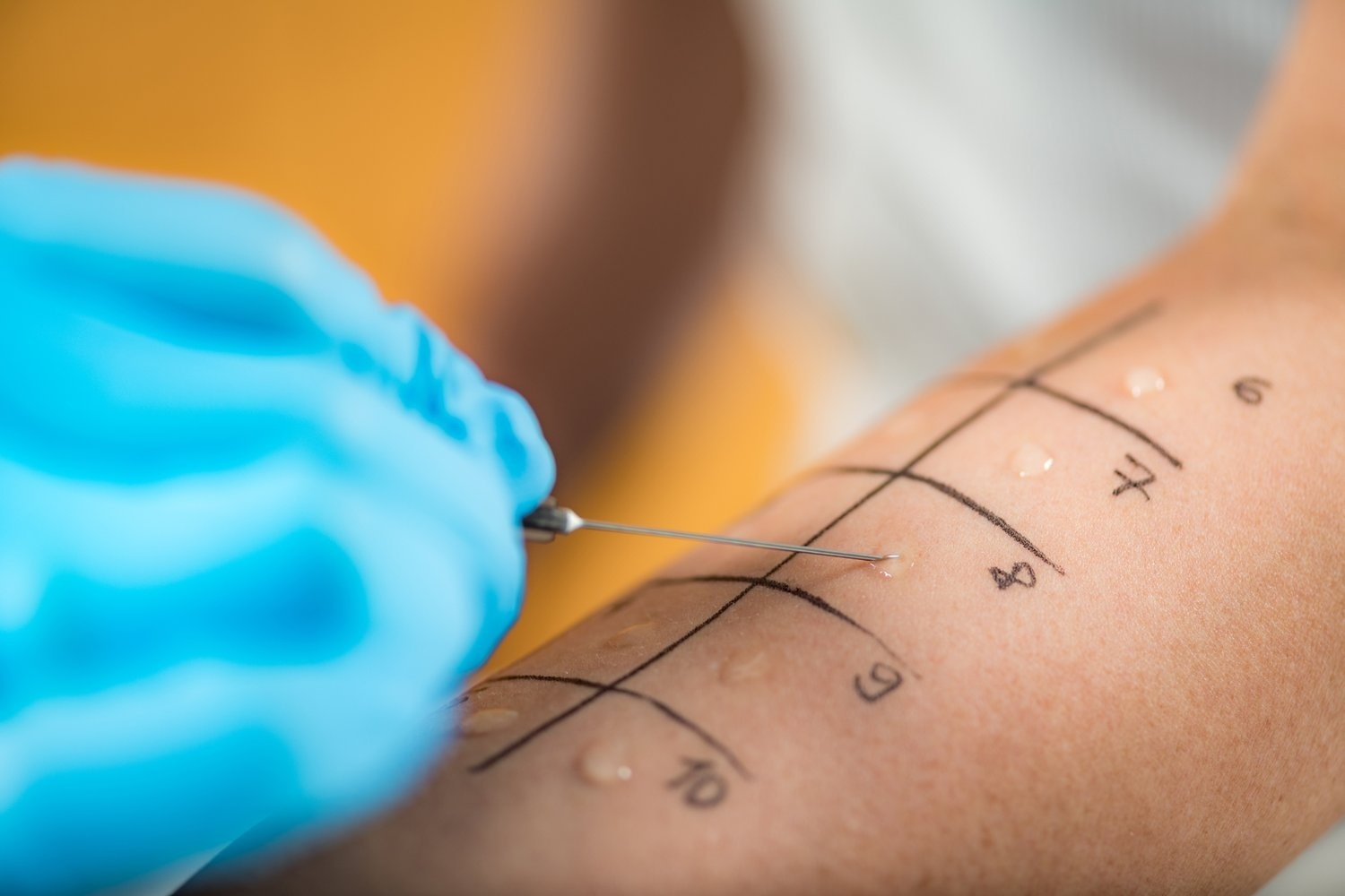 allergy-test-quiz