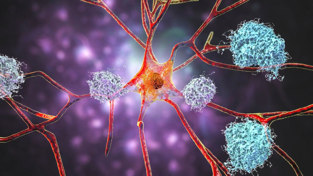 alzheimer-quiz