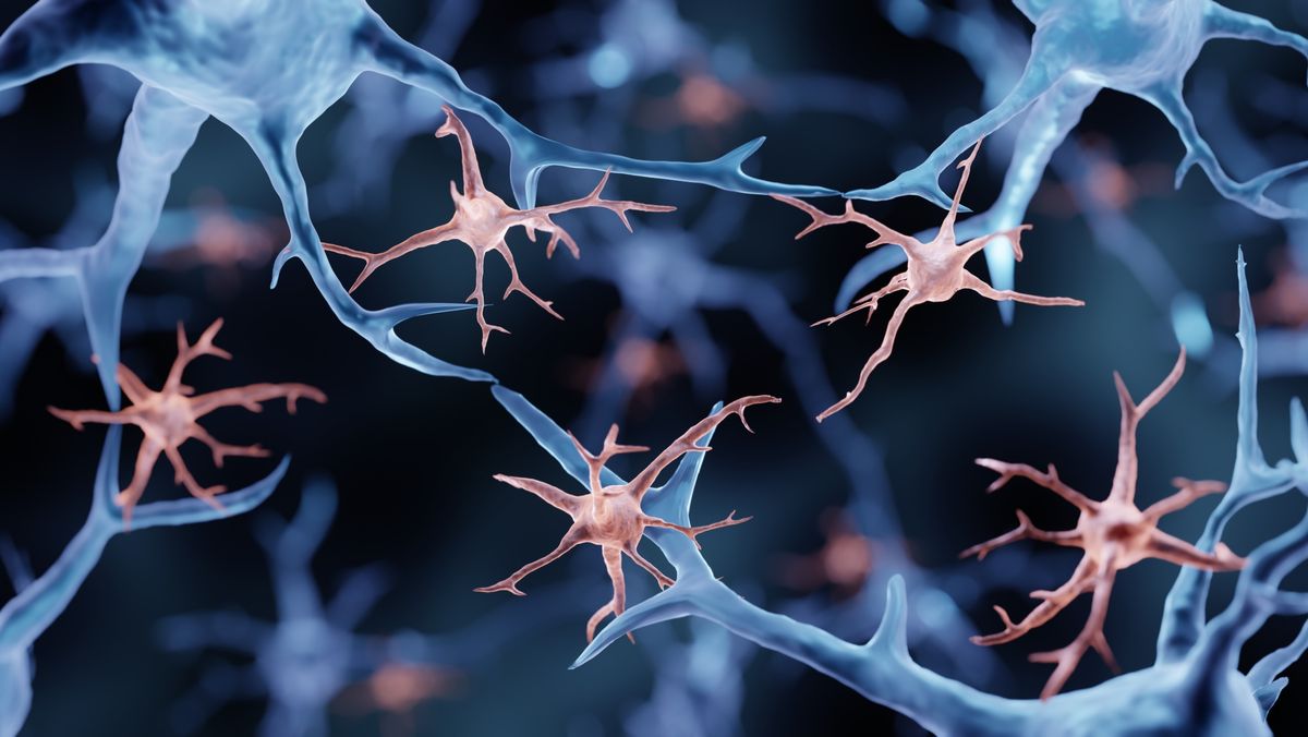 brain-damage-quiz