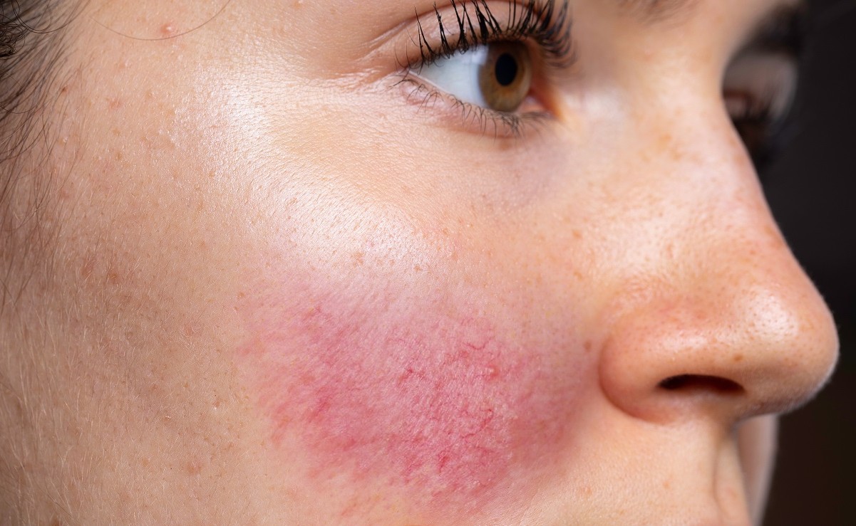 makeup-allergy-quiz